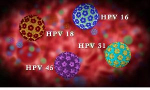Kadınlarda HPV Virüsü Belirtileri ve Tedavi Yöntemleri