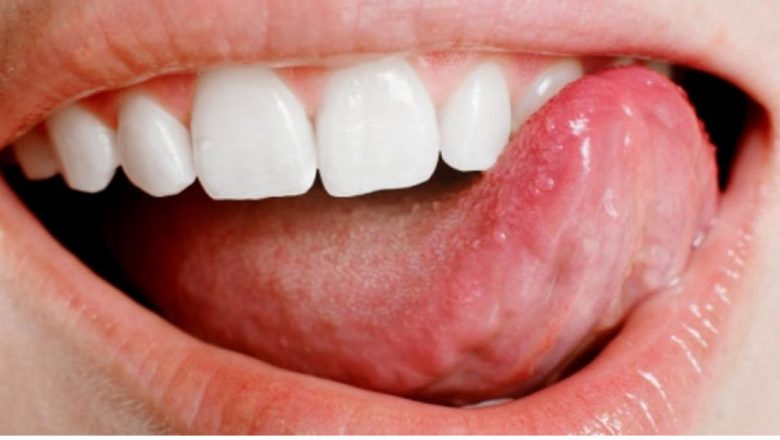  Dildeki yaralara ne iyi gelir ? Nasıl Geçer ? Evde Bitkisel Çözüm